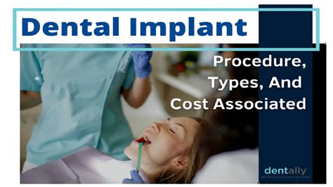 Dental Implant – Procedure, Types, And Cost Associated