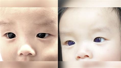 Infant's dark-brown eyes suddenly turn indigo blue after COVID-19 antiviral treatment. But why ...