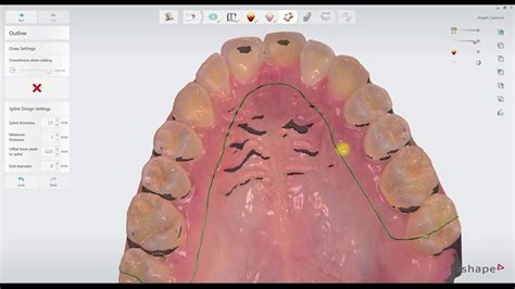 Image result for 3Shape Tutorials