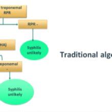 Image result for Syph Reverse Algorithm