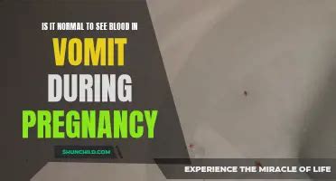 Why Feeling Cold In Early Pregnancy Is Common: Understanding The ...