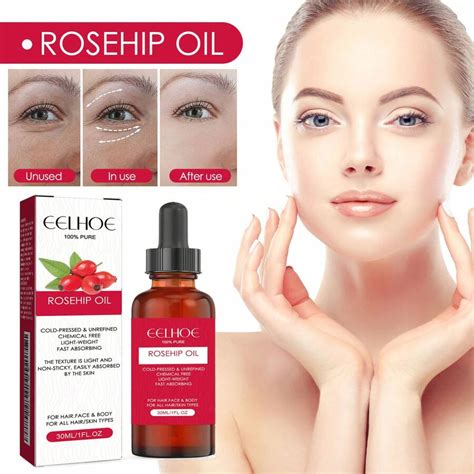 1 doos 1 stuk (30 ml) Rozenbottel gezichtsolie, hydraterende en ...