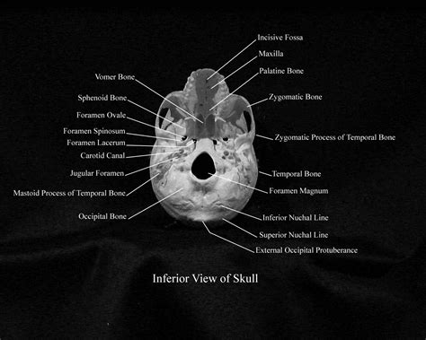 Inferior Skull Labeled Cranial Foramina Foramen Ovale Skull