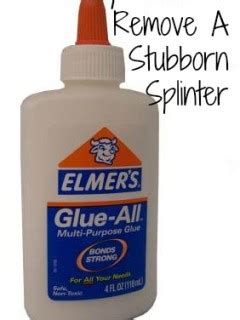 Image result for Remove Splinter