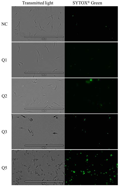 Acrylonitrile Derivatives against Trypanosoma cruzi: In Vitro Activity ...