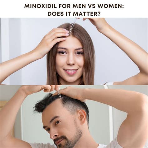 Minoxidil Foam vs Liquid: The Right Solution for Hair Regrowth | Clinikally