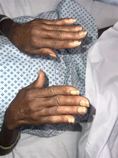 MRCP PACES Exam Dates and Preparation Time 2025: Everything You Need To Know