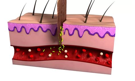 Peceleganan spray effective and safe in wound infection, says study.