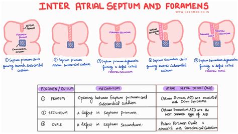Inter Atrial Septum and Foramens