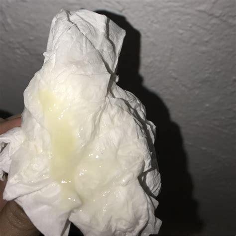 Can anyone tell me what this is? My vulva been really itchy, it burn to pee at one point in time ...