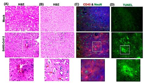 Neuroinvasion and Encephalitis Following Intranasal Inoculation of SARS ...