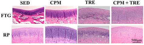 Can Early Rehabilitation Prevent Posttraumatic Osteoarthritis in the ...