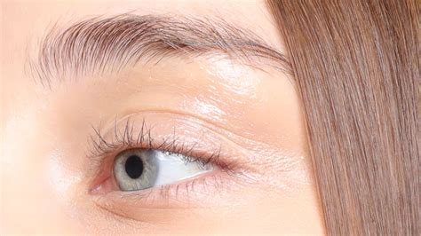 Eyelid Dermatitis Eyelid Dermatitis (xeroderma Of The Eyelids, Eczema