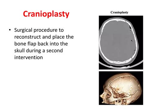 Craniotomy.pptx