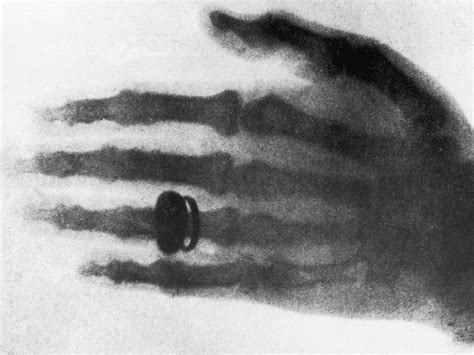 The first X-ray photograph : Rhodri Marsden's Interesting Objects No.86 | Science | News | The ...