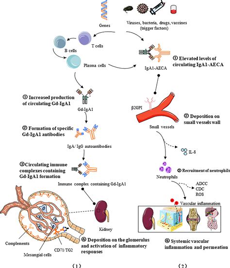 Frontiers | IgA vasculitis update: Epidemiology, pathogenesis, and biomarkers
