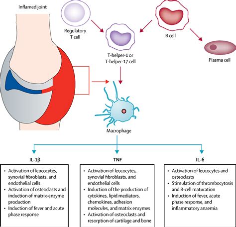 Current and future perspectives in the management of juvenile idiopathic arthritis - The Lancet ...
