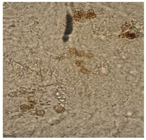 Antibiotics | Special Issue : Newer Therapies for Bacterial and Fungal ...