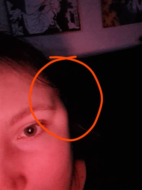 Temple Swelling after chewing? (19F) : r/Hashimotos