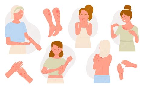 Alergia en la piel del cuerpo conjunto de dermatología infografías médicas síntomas alérgicos ...