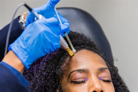 Top Signs You Need PRP Hair Therapy for Hair Loss Recovery - Hair Ensure