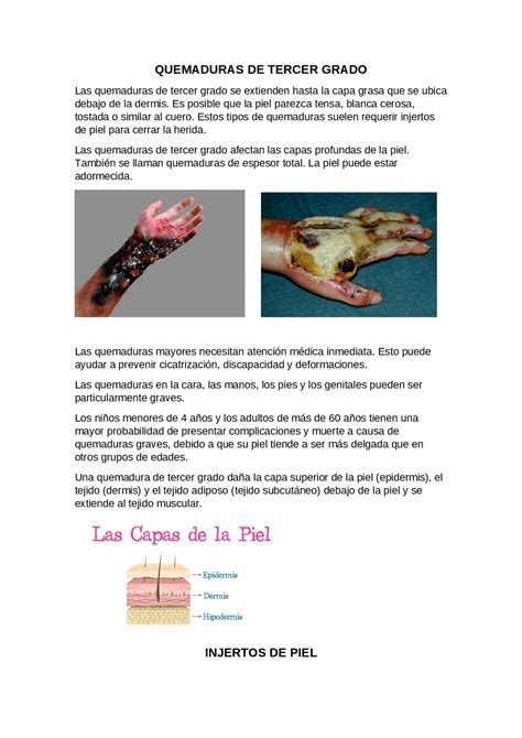 Tratamientos De Quemaduras De Tercer Grado – ELXJC