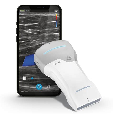 GE Vscan Handheld Ultrasound