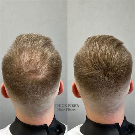 Thick Fiber Instantly Conceal Bald Spots & Thinning Hair - 25g India | Ubuy