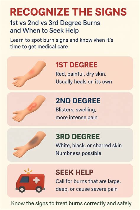 Recognize the Signs: 1st vs 2nd vs 3rd Degree Burns and When to Seek Help