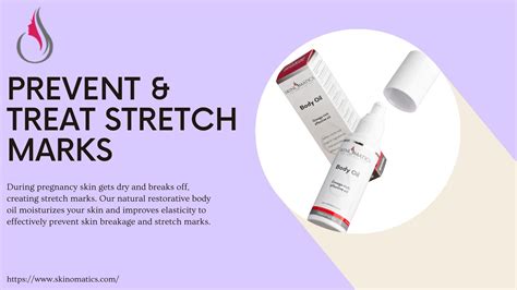 Bio oil pregnancy - Skinomatics by Skinomatic - Issuu