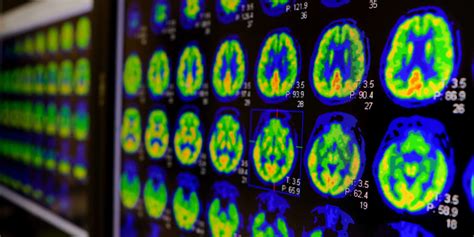 Nuclear Medicine’s AI Uptake - The Imaging Wire