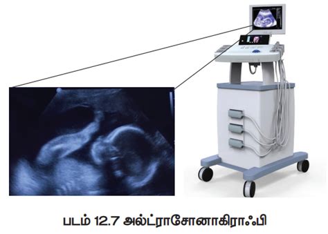 நிழலுரு கருவிகள் (Imaging Instruments) | Imaging Medical Instruments ...