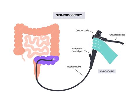 Premium Vector | Colonoscopy and sigmoidoscopy test Examination and treatment of the large ...