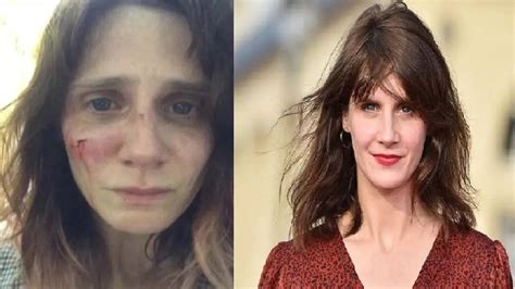 French Actress Judith Chemla victim of domestic abuse, posts photos of ...