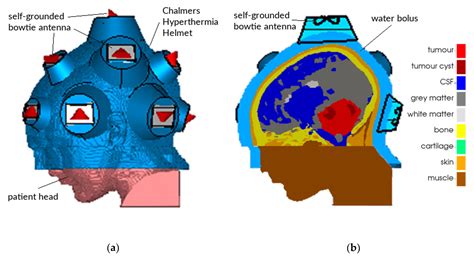 Hyperthermia Treatment Planning Including Convective Flow in ...