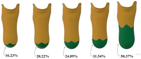 Two-Material-Based Transtibial Socket Designs for Enhanced Load-Bearing ...