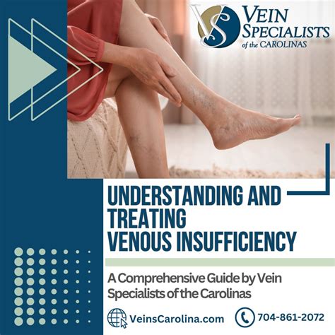 Will Exercise Help Venous Insufficiency at Timothy Samons blog