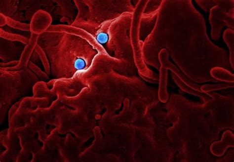 Ultimate guide on What is Disease