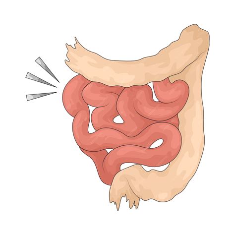 Small intestine | Premium Vector