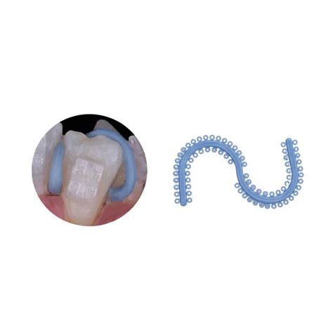 Buy U Ortho Separators – Oralkart