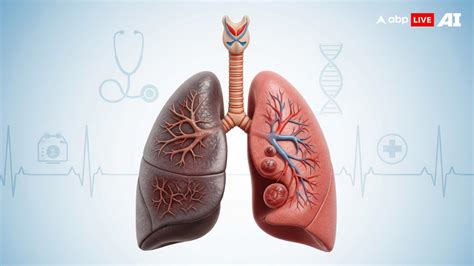 Is Your Shortness Of Breath A Warning Sign? Understanding Early ...