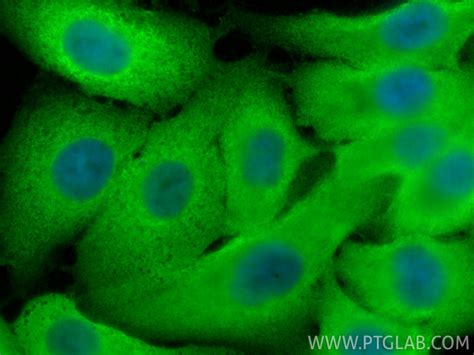 UCH-L1/PGP9.5 antibody (RMX00043) | Proteintech
