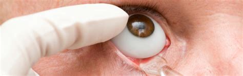 3D printing: manufacturing eye prostheses from plastic
