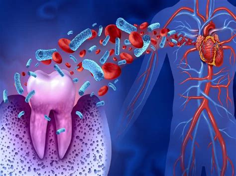 Bacteria In Your Mouth Can Block Your Heart Arteries, Cause Severe Lung ...