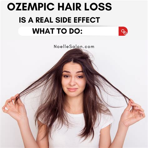 Understanding Ozempic Hair Loss: Causes and Solutions – noellesalon