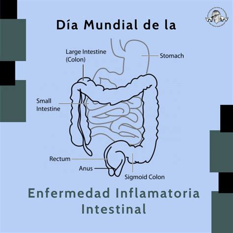 Enfermedad Inflamatoria Intestinal: Situación Actual De Las – HHCT