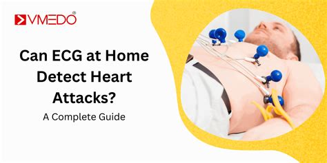 Can ECG at Home Detect Heart Attacks? A Complete Guide - VMEDO Blog