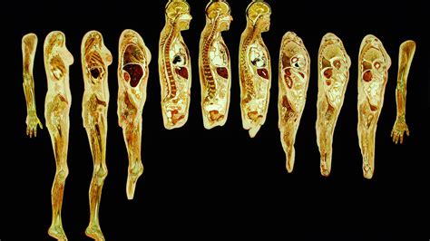 The “Body Worlds” exhibit | Fox News