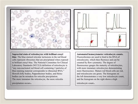 Hemolyic Anemia ppt | PPTX