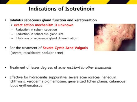 Isotretinoin safety guideline | PDF